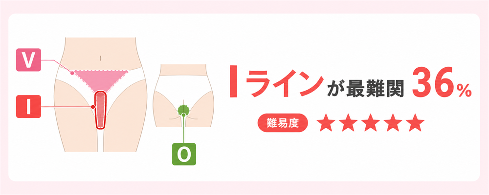 VIOの部位を示す図解
