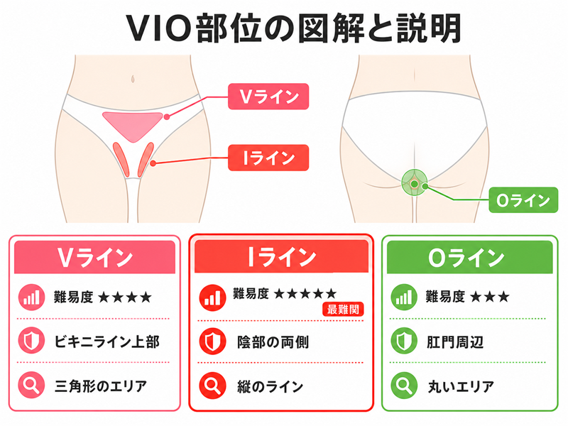 VIO脱毛