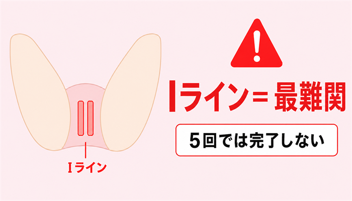 Iライン難関の警告
