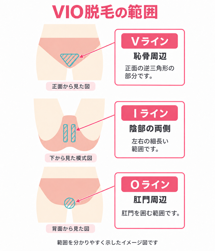  VIOの範囲を示した人体図